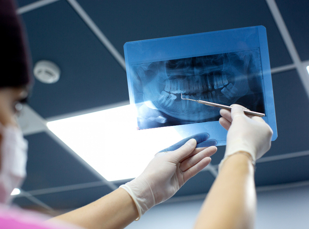 Рентгеновский снимок зубов