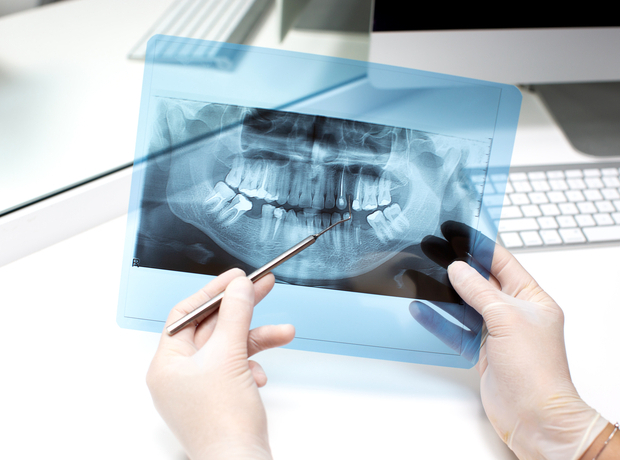 Панорамный рентген зубов